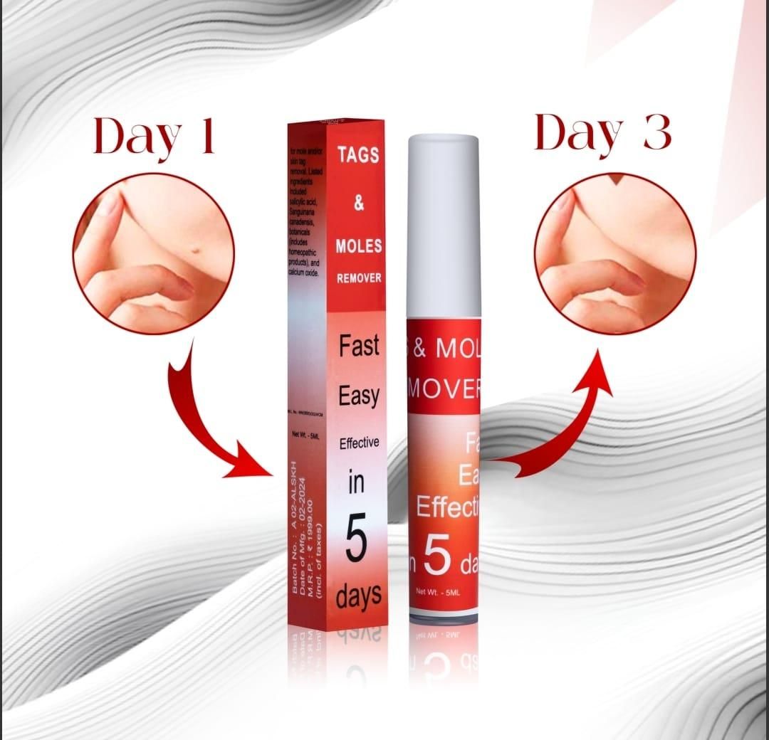 WipeOff Tags & Mole Remover (BUY 1 GET 1 FREE)