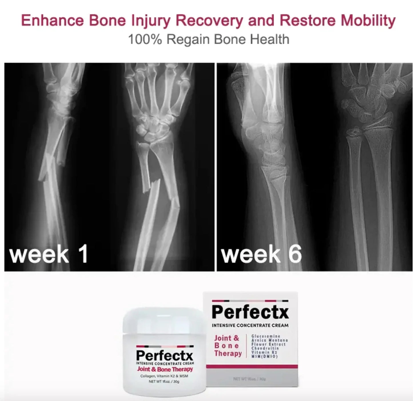 Perfectx Joint and Bone Treatment Cream (Buy 1 Get 1 Free)